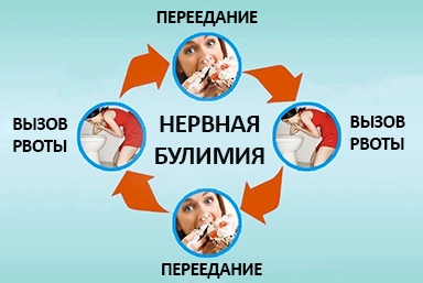 Лечение булимии в Киреевске